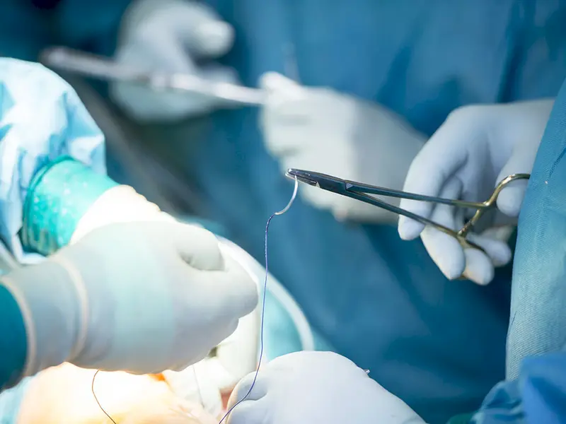 Operation