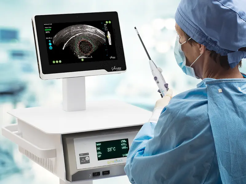 Behandlung von Gebärmutter-Myomen ohne Operation mit Sonata-Gerät  