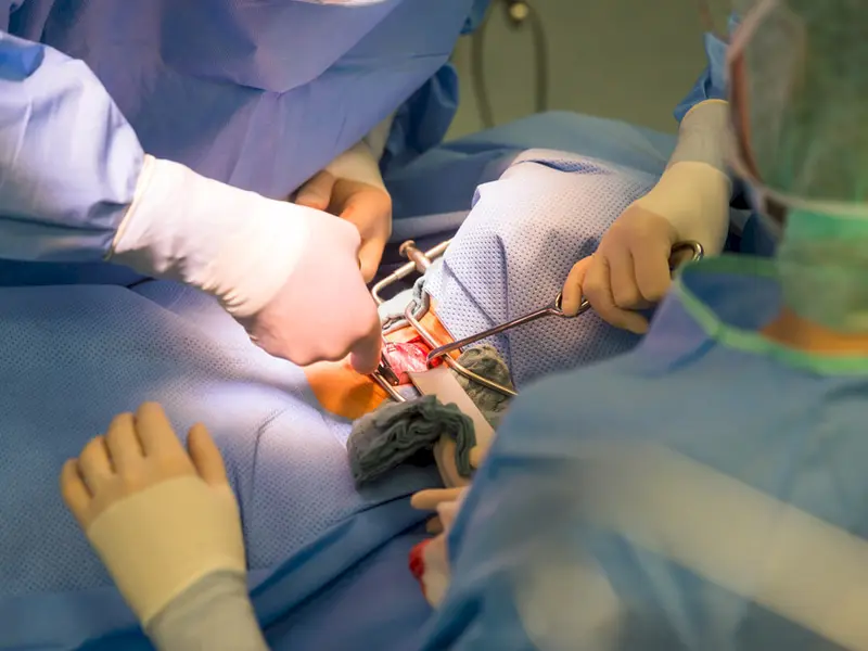 Schilddrüsenoperation